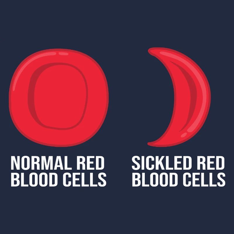 Sickle cell anemia