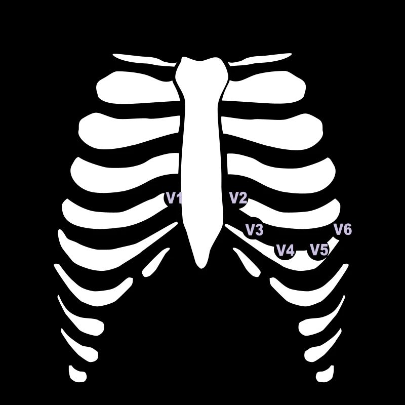 12 Kanal EKG