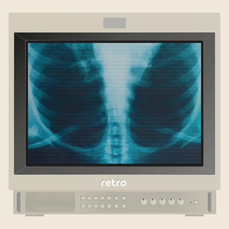 PVM Lover - Röntgen