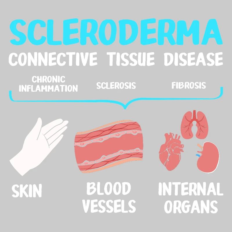 Scleroderma