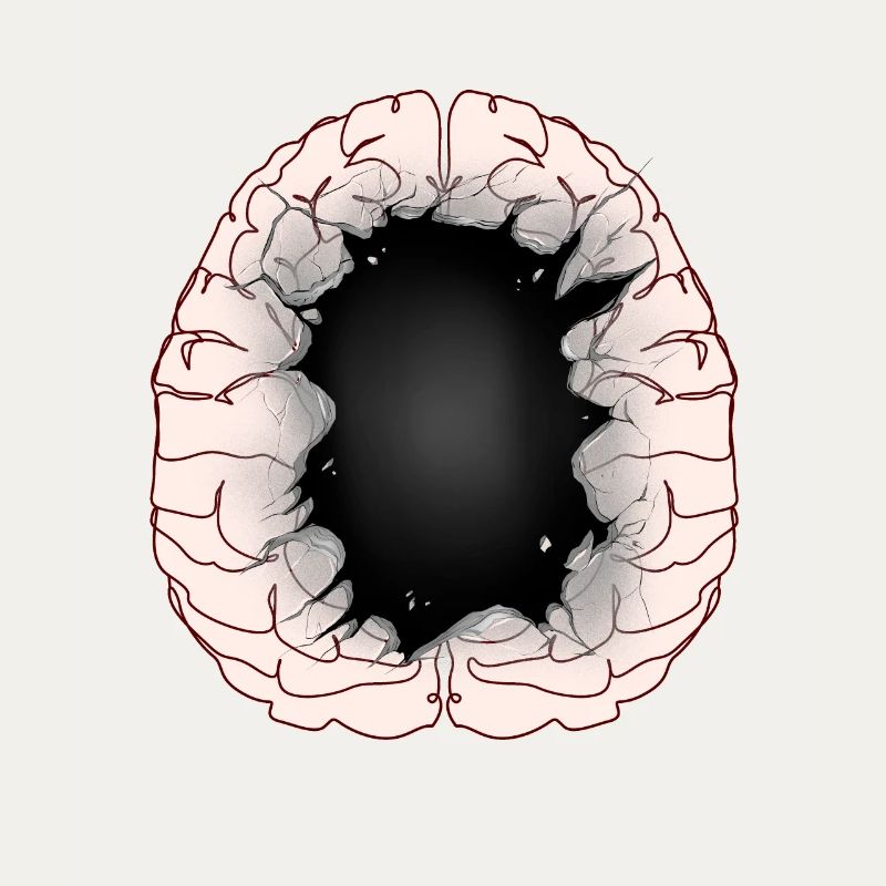 Brain Idiot Idiot Brain Brains Intelligence