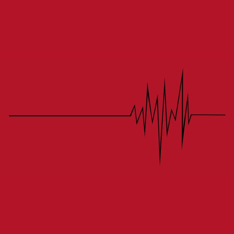 ECG (md)