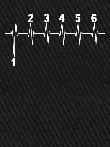 Motorcycle Speed