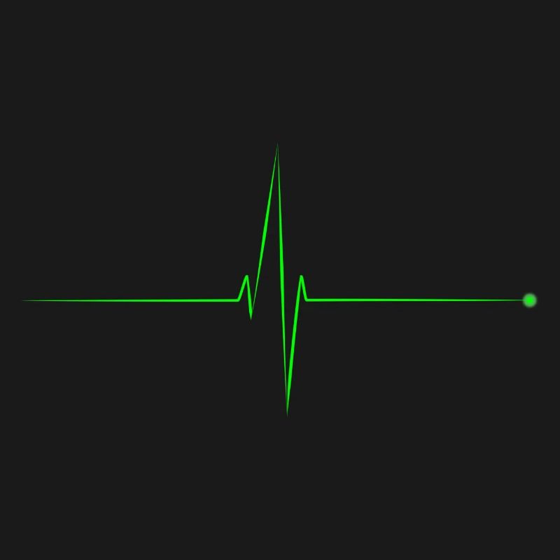 electrocardiogram