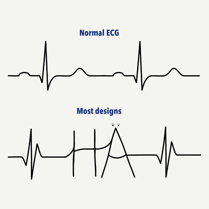 Electrocardiogram (ECG) - Normal versus Hä?