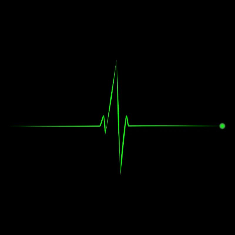 electrocardiogram