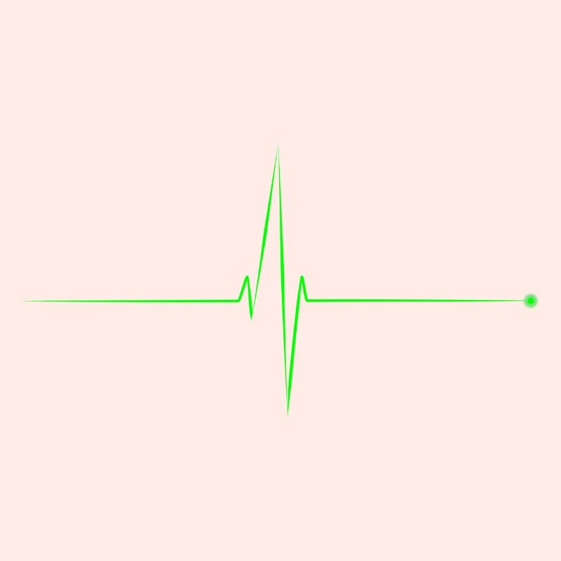 electrocardiogramme