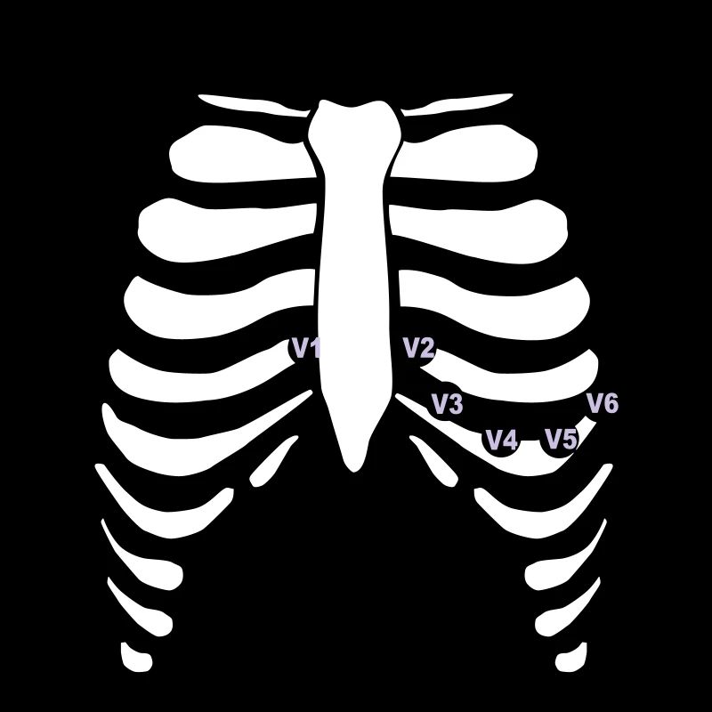 12 Kanal EKG