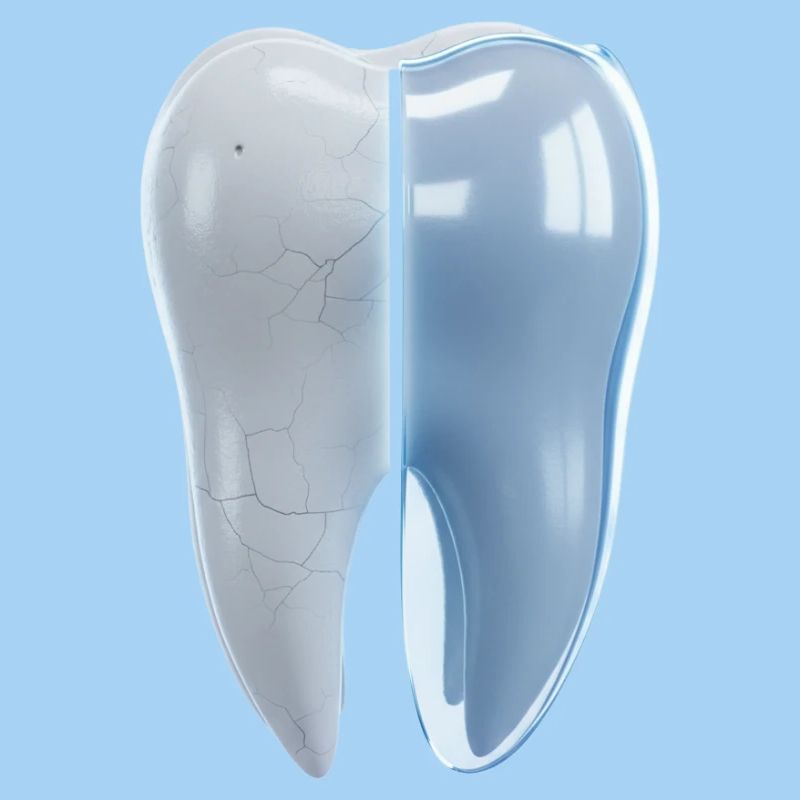 gesunder-kaputter-zahn-vorher-nachher-3d