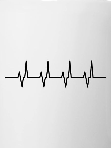 pulsation