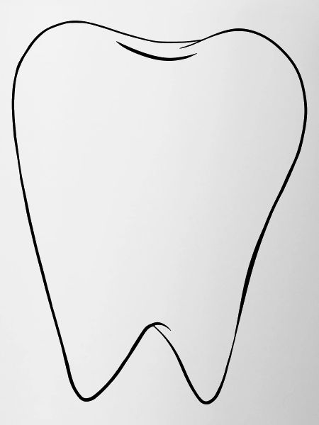 Dent