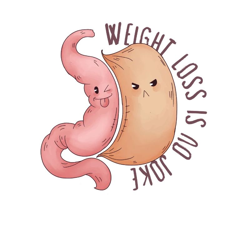 Sleeve gastrectomy sleeve gastrectomy