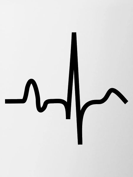 EKG