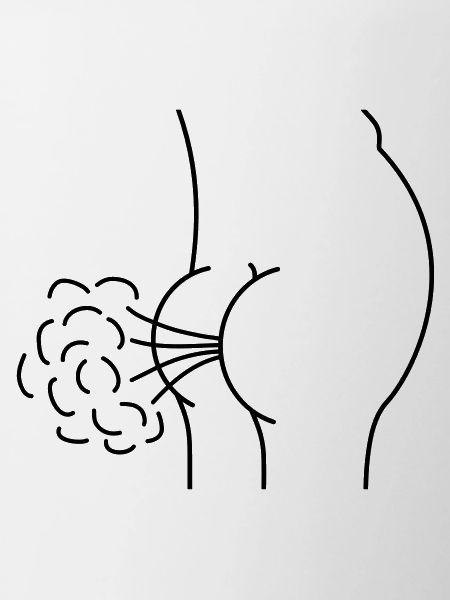 Fart