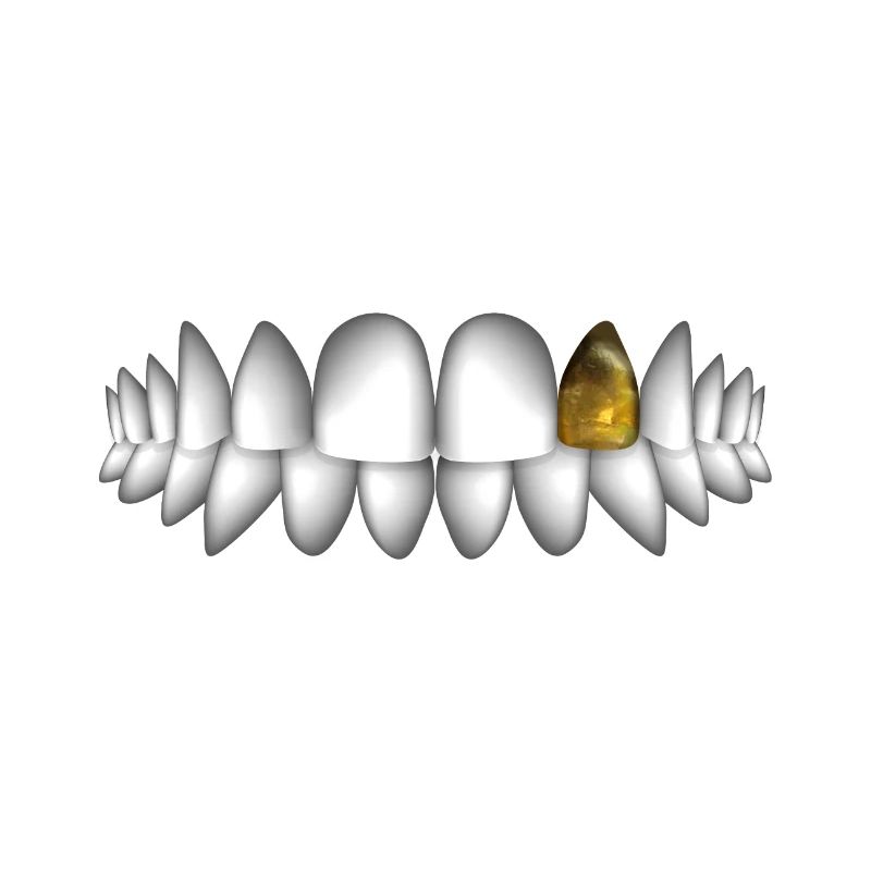 teeth with gold tooth