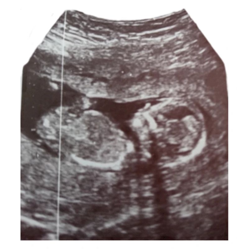 Babyloading... Please be patient! Ultrasound