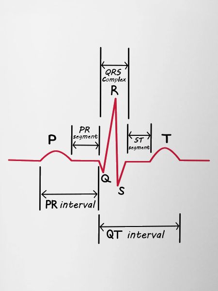 Ecg
