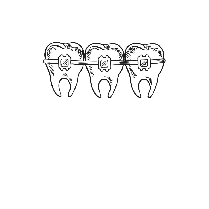 Brackets Feste Spange