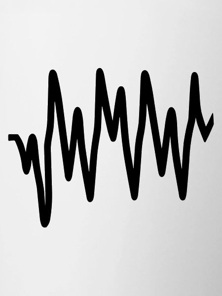 Heartbeat
