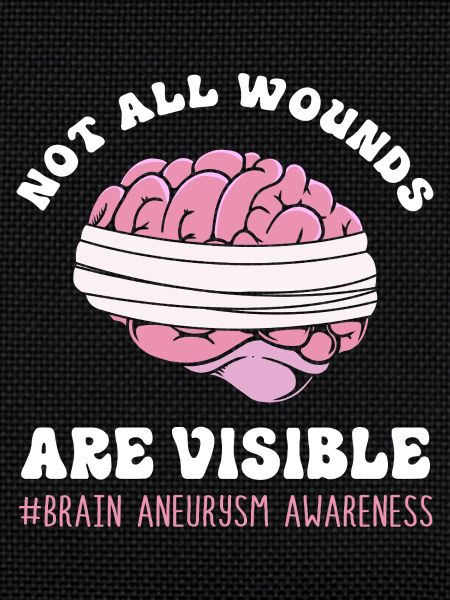 Brain Aneurysm