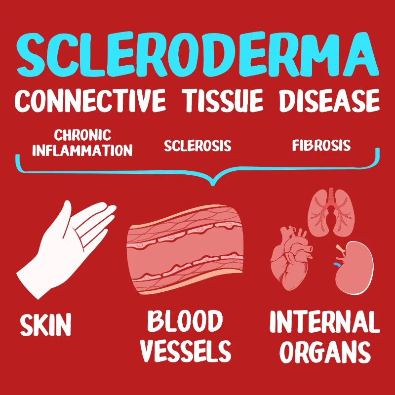 Scleroderma