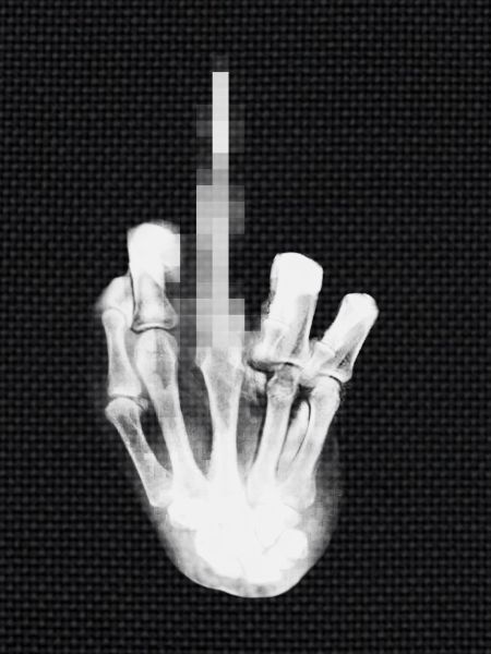 Fuck you