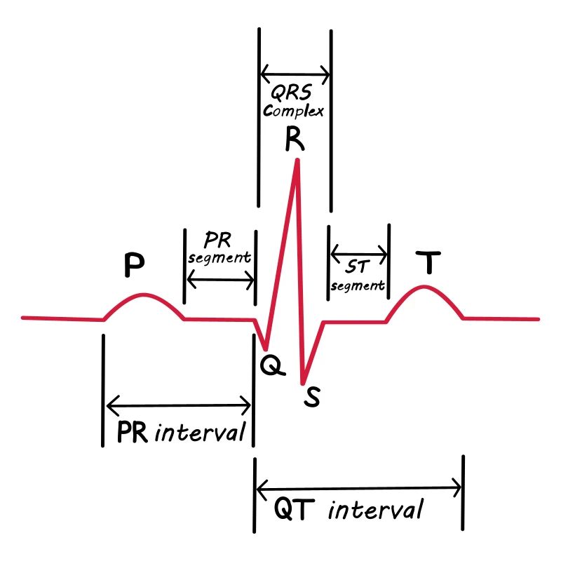 ECG