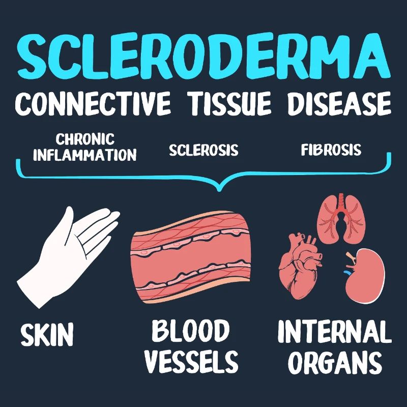 Scleroderma