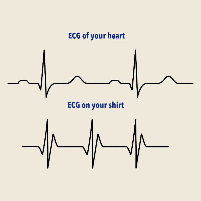 Elektrokardiogramm (EKG) echter Rhythmus vs. Mode
