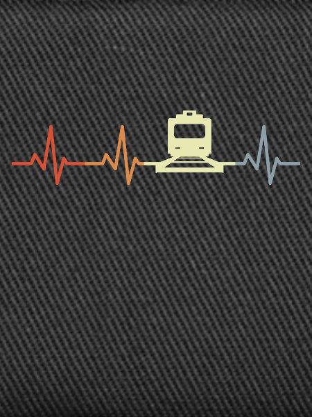 Trains ECG palpitations