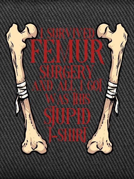 Leg fracture Broken thigh