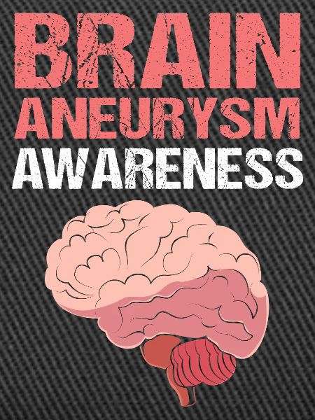 Brain Aneurysm