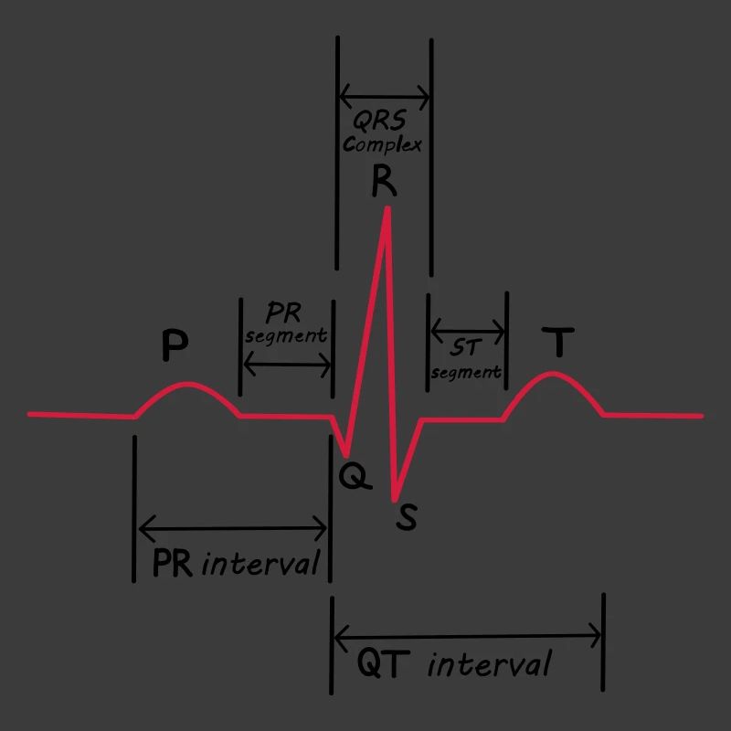 ECG