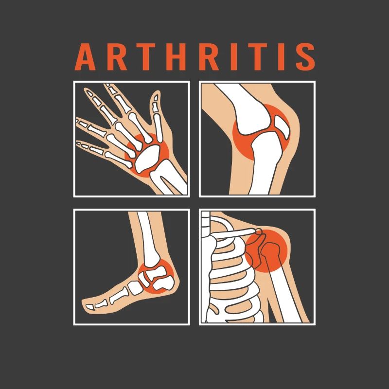Arthritis Rheuma