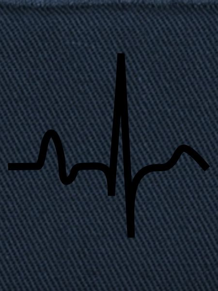 EKG