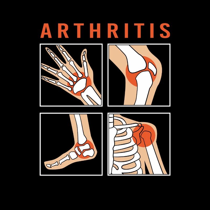 Rhumatisme arthrithrique