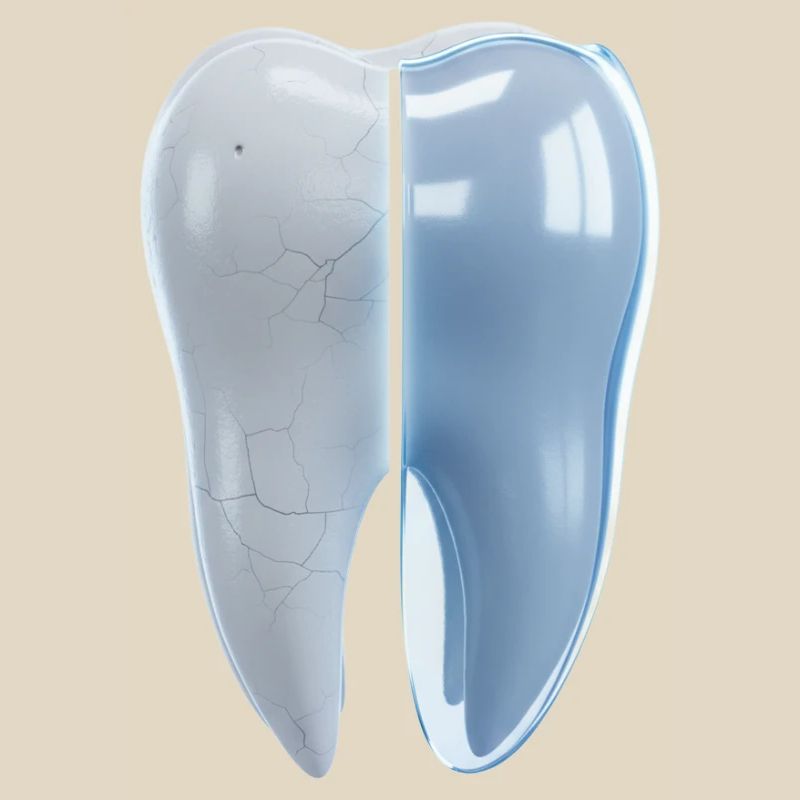 healthy-broken-tooth-before-after-3d