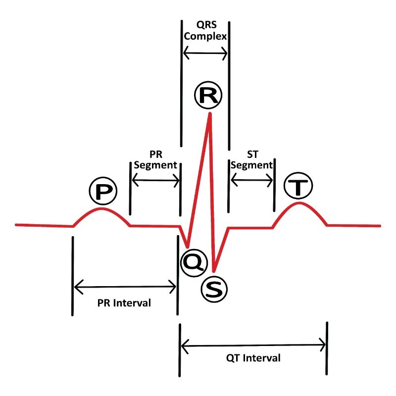 ECG v2