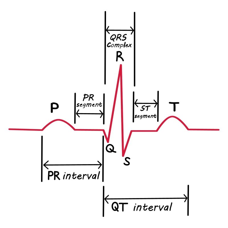 ECG