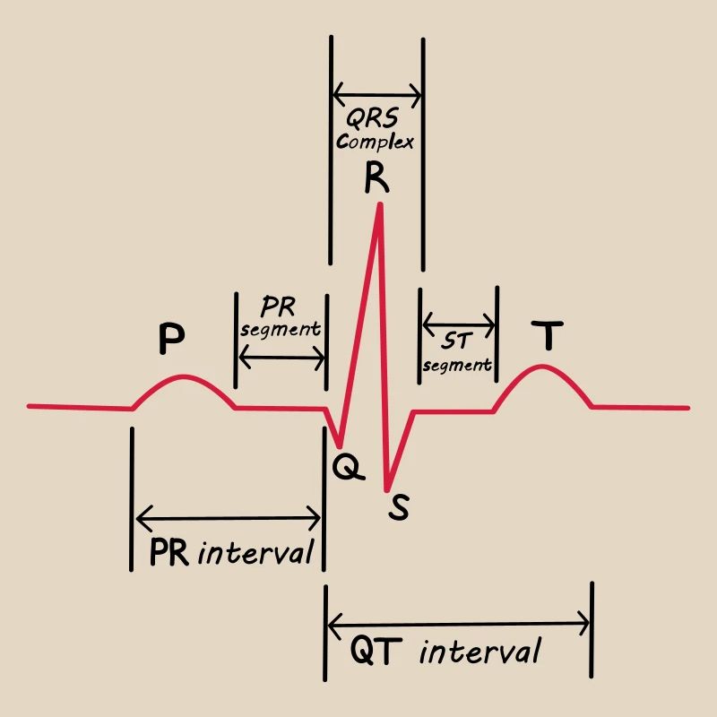 ECG