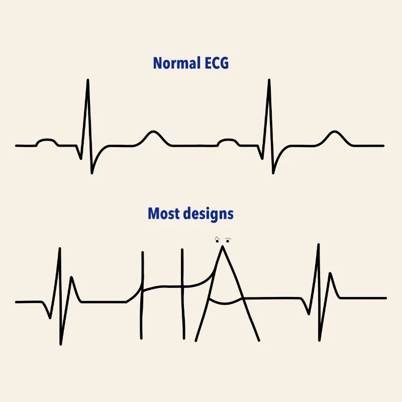 Électrocardiogramme (ECG) - Normal versus Hä?