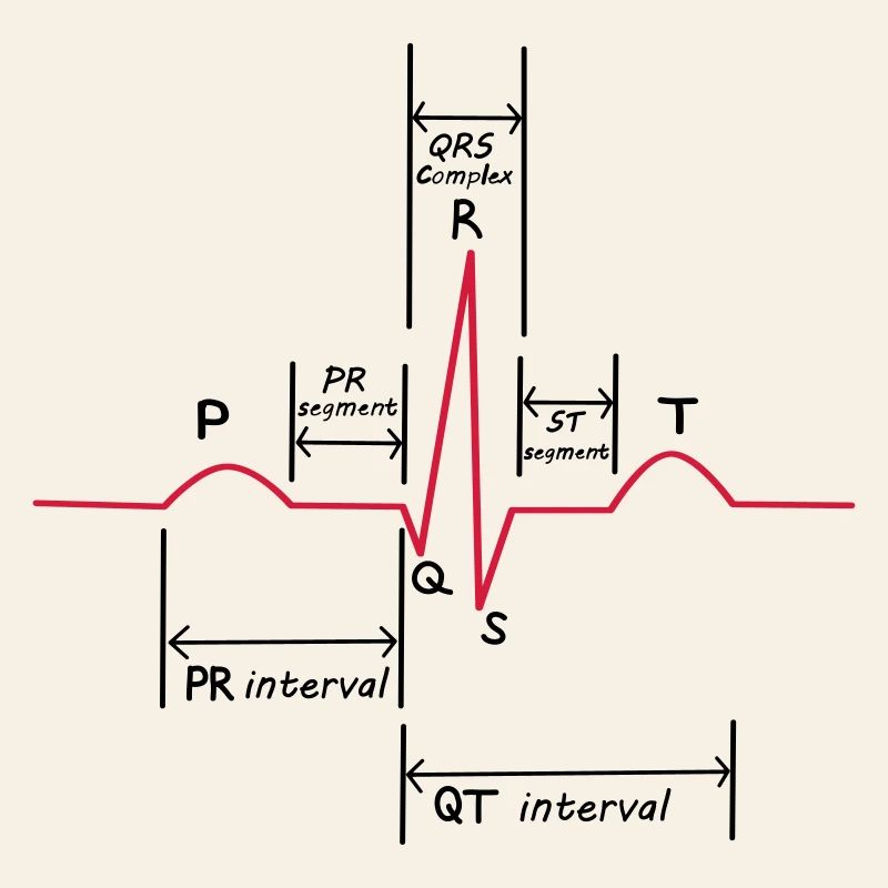 ECG
