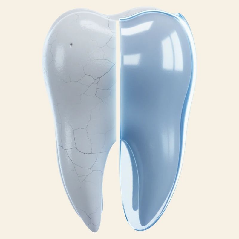 healthy-broken-tooth-before-after-3d