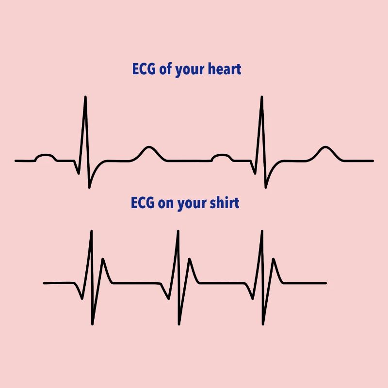 Elektrokardiogramm (EKG) echter Rhythmus vs. Mode
