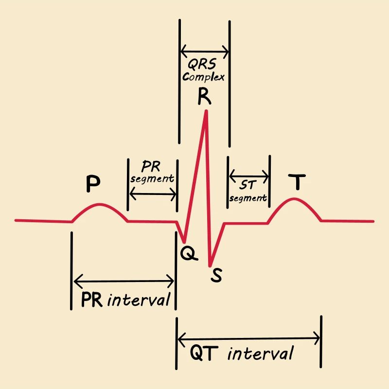 Ecg
