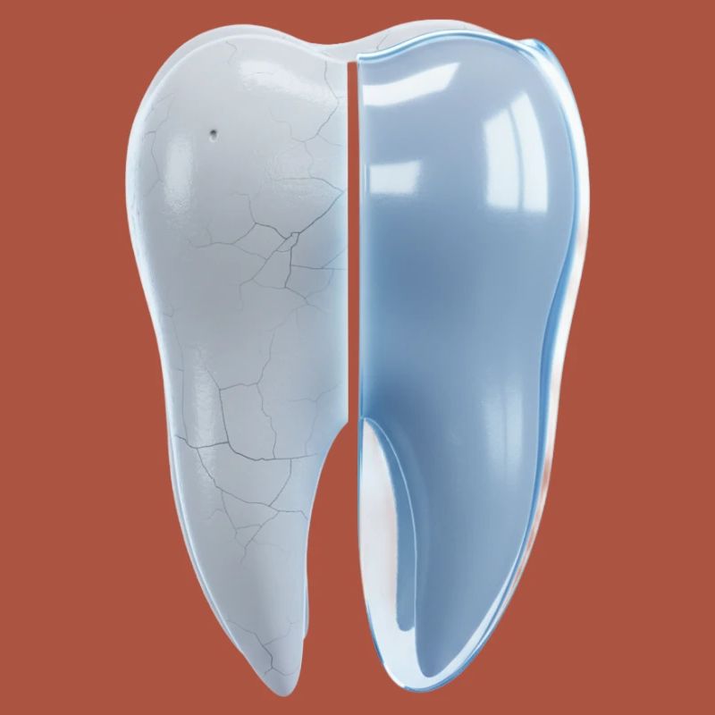 gesunder-kaputter-zahn-vorher-nachher-3d