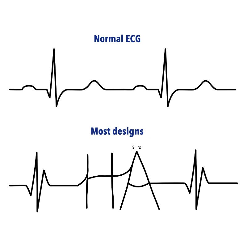 Electrocardiogram (ECG) - Normal versus Hä?