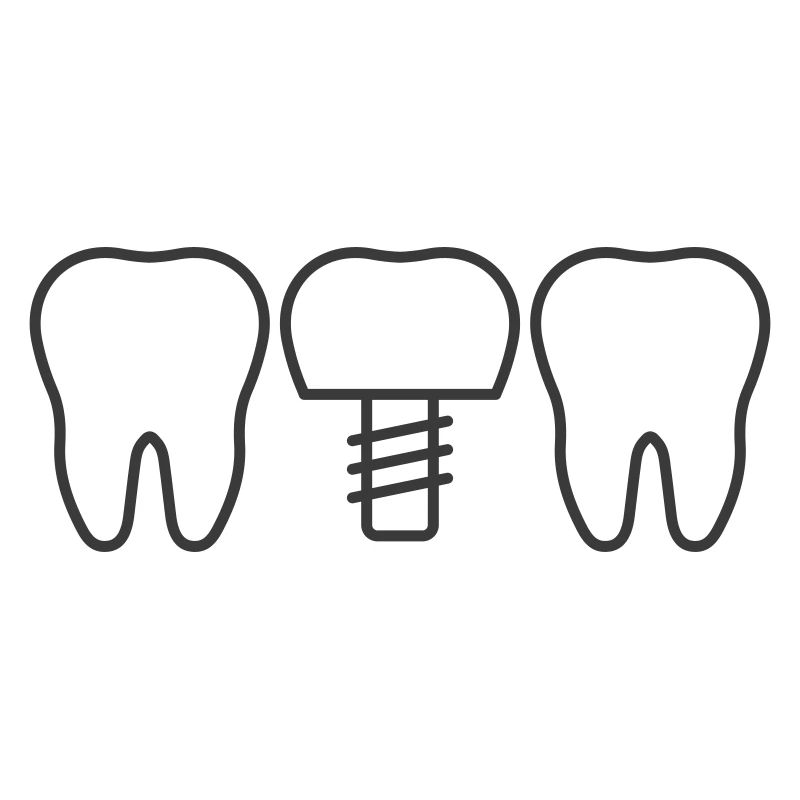 Dental Implant Line Icon – Tooth Replacement Symbo