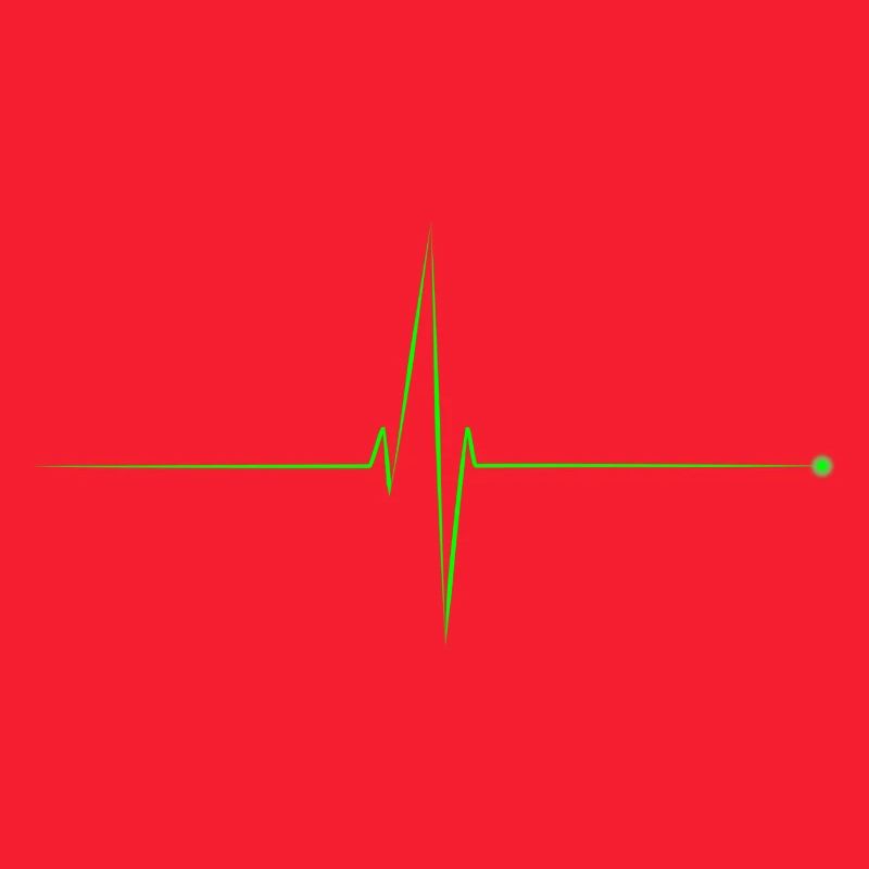 electrocardiogram