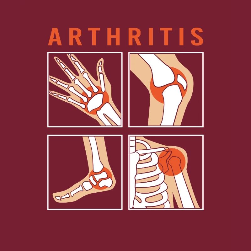 Arthritis Rheuma